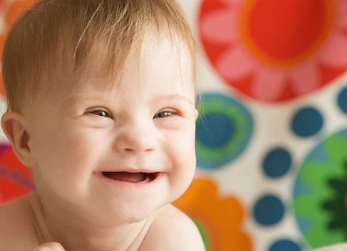 Día Mundial del Síndrome de Down: “los derechos no tienen cromosomas”