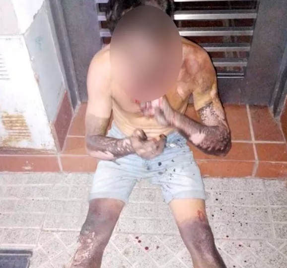 Otra vez, un delincuente resultó quemado intentando robar cables en Rosario