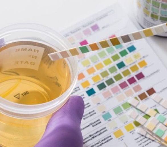 Buscan promover los exámenes toxicológicos obligatorios a todos los funcionarios
