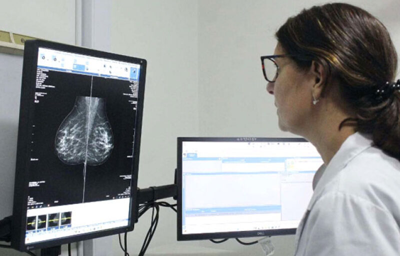 La Provincia indicará la primera mamografía a los 40 años