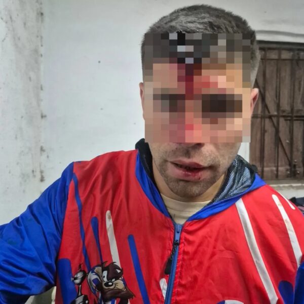 Le clavaron una llave de auto en la cabeza a un exjugador de Berazategui